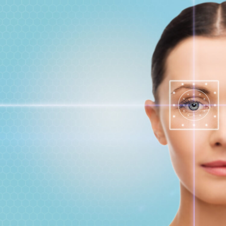 Lasik