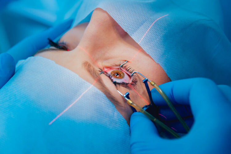 Photorefractive Keratectomy (PRK)