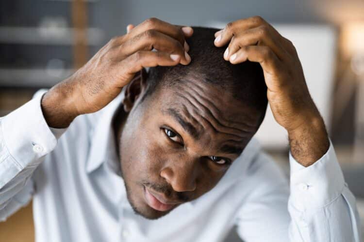 Hair Transplant